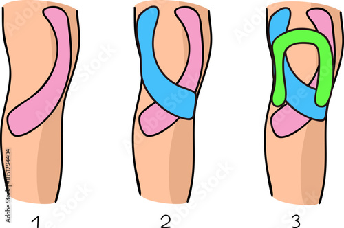Step-by-step instructions on how to apply kinesiology tape to the knee. Vector illustration.