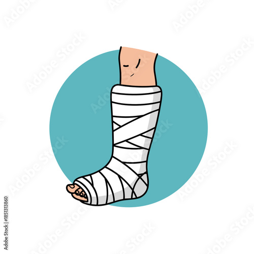Leg in cast with bandages on turquoise circular background  