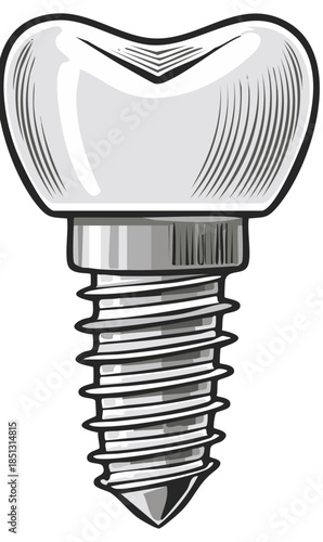 Dental Implant Illustration with Threaded Titanium Post for Tooth Replacement