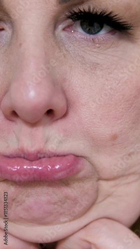 Mature woman touching her chin showing excess fat and contemplating submental liposuction neck liposuction procedure for a refined jawline silhouette