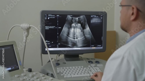 Doctor looking at ultrasound screen displaying a medical image of internal organs during a diagnostic procedure in a clinic