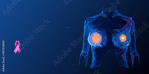 Polygonal illustration of a human torso with a pink ribbon for breast cancer awareness