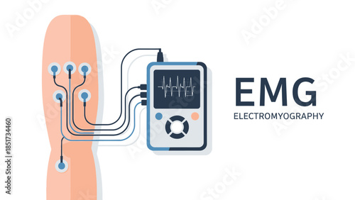 Electromyography (EMG) diagnostic test illustration with electrodes and monitor.