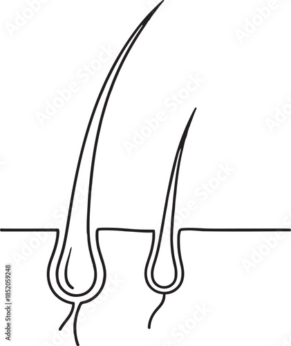 Simplified diagram illustrating the structure of two distinct human hair follicles and shafts