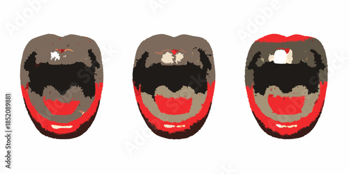 Three stylized mouth illustrations displaying varying degrees of redness and detail