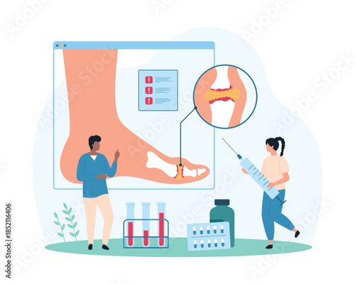 Diagnosis and treatment of gout, inflammatory arthritis of foot joints, rheumatology. Tiny people study infographic medical chart of ankle, watch out for uric acid crystals cartoon vector illustration