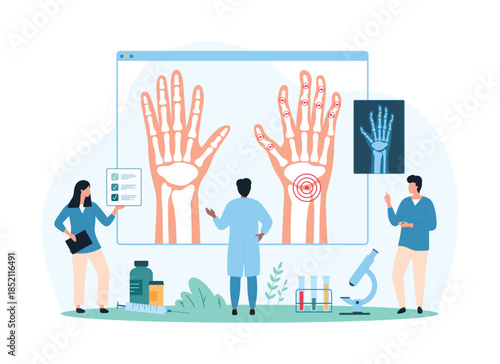 Diagnosis and treatment of osteoarthritis, rheumatoid arthritis and rheumatism, awareness of joint diseases. Tiny people examine xray of patients wrists with inflammation cartoon vector illustration