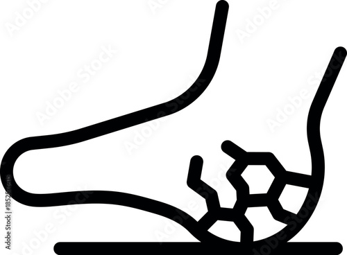 Foot heel with dry cracked skin standing on the floor, suffering from pain and discomfort