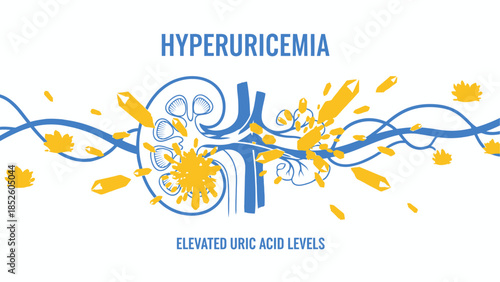 Hyperuricemia and Kidney Health Illustration – Uric Acid Crystals in Bloodstream.