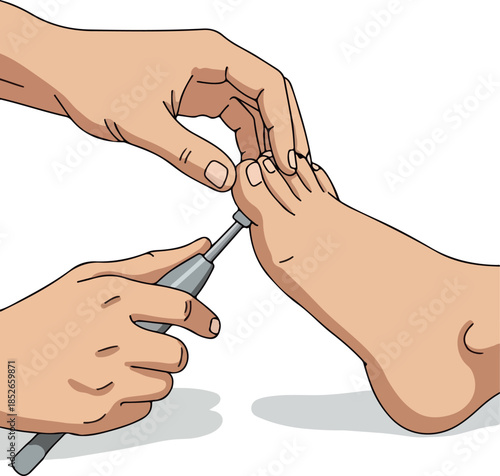 Medical Exam Of Human Foot With Reflex Hammer By Doctor
