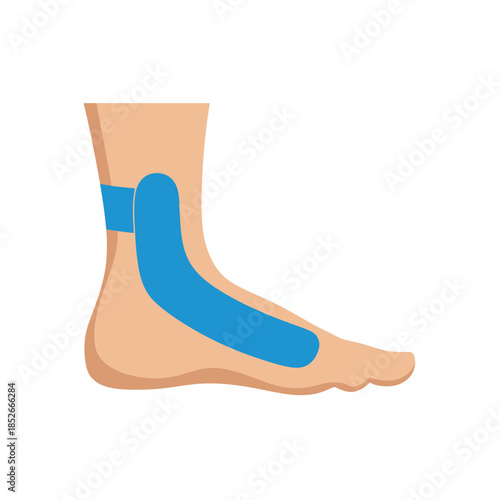 Close-up of a human foot with blue kinesiology tape applied to support the arch and ankle.