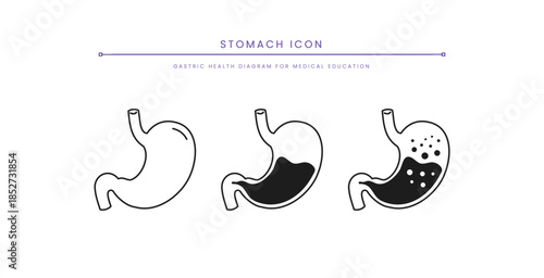 Medical Stomach Problem Diagram for Healthcare. Stomach Anatomy