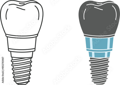 Dental implant illustration isolated on white background a dental implant is a surgical component that interfaces with the bone of the jaw or skull
