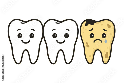 Cartoon teeth showing progression of tooth decay