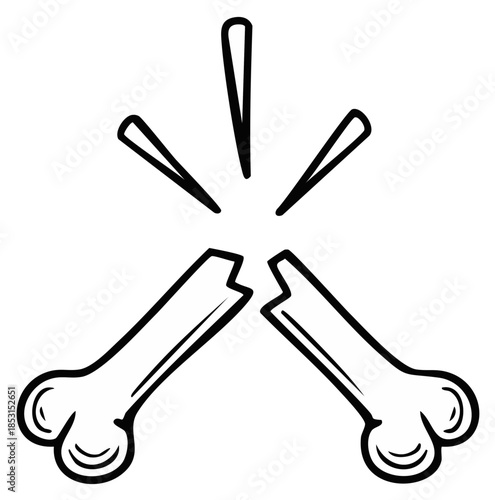 Broken bone cartoon drawing with radiating lines depicting sudden impact or fracture