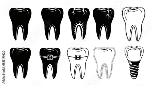 Vector art illustrating dental health conditions healthy teeth, decay, cracks, orthodontic braces, and a modern dental implant, perfect for healthcare design