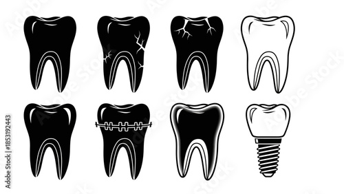 Dental Implant Procedure Illustrated with Various Tooth Conditions and Implant Stages