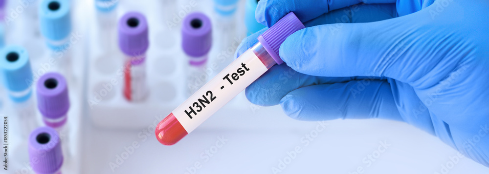 Fototapeta premium Doctor holding blood sample tube labeled ?3N2 influenza a virus test, laboratory diagnostics concept highlighting seasonal epidemic risk, vaccination importance and early antiviral treatment