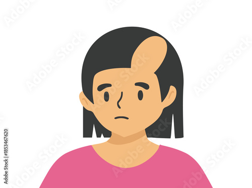 Hand Drawn Female Androgenetic Alopecia
