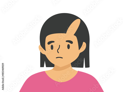 Hand Drawn Female Androgenetic Alopecia
