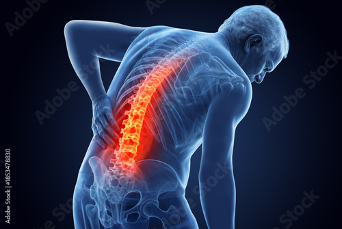 Back pain illustration in X-ray 
