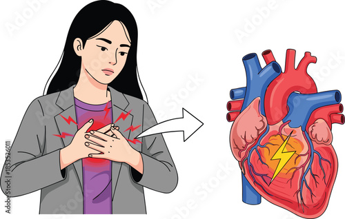 Woman experiencing chest pain, heart attack concept, cardiovascular disease illustration, medical health awareness, anatomy comparison, flat vector, emergency, symptoms, diagnosis