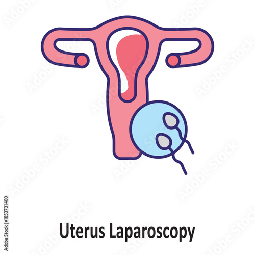 Uterus Laparoscopy Vector Icon which can easily modify or edit