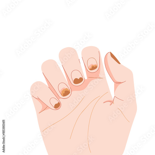 Hand showing dirty fingernails stained from tobacco use  