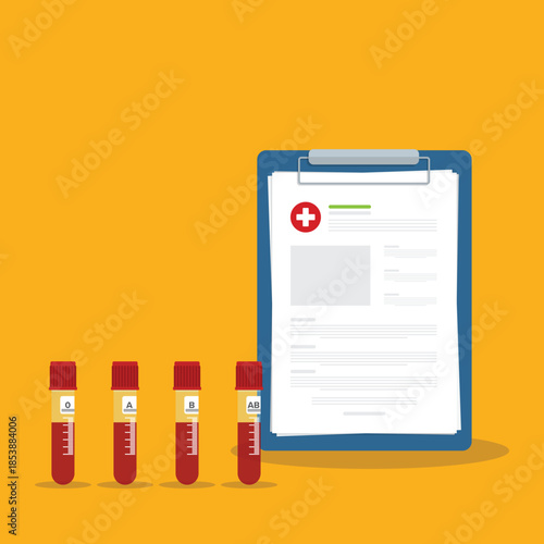 A row of human blood samples in a medical laboratory ready to be tested. healthcare background.