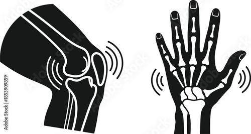 Anatomy illustration of a hand and knee joint with pain on transparent background silhouette
