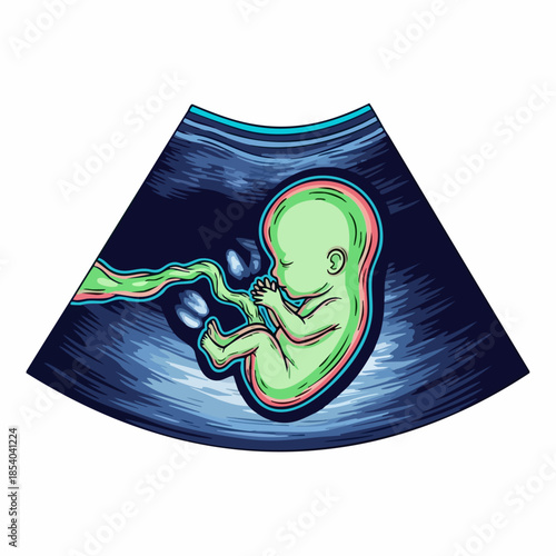 Fetus ultrasound illustration showing developing baby inside womb with umbilical cord. This fetus ultrasound provides detailed medical imaging for prenatal care and diagnostics.