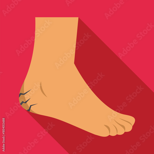 Human foot illustrating cracked heel skin condition, needing care