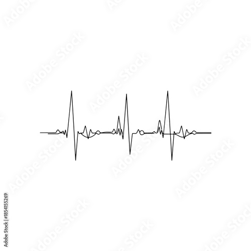 Electrocardiogram (ecg) waveform isolated on transparent background