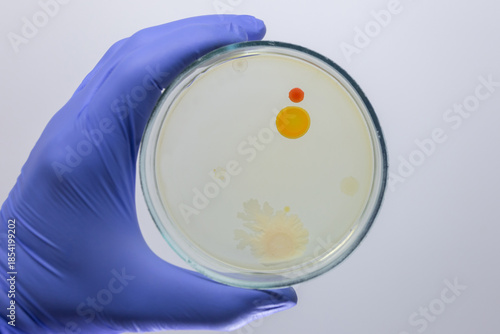 Three different bacterial colonies on a Petri dish held by a hand against a grey background.