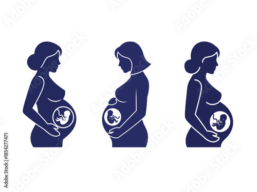 Illustrative depiction of a pregnant woman's body showing the progression of gestation stages over