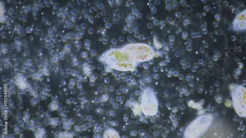 Single-celled paramecium with symbiotic alga inside