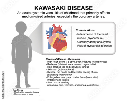 Kawasaki Disease Meidcal Education Flashcard