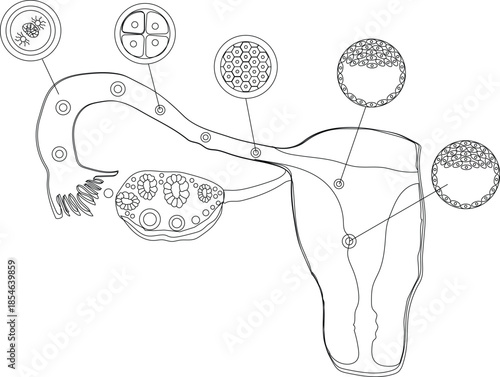 IMPLANTATION vector icon