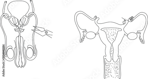 Vasectomy, Ligation vector icon