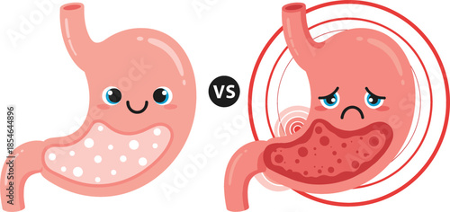 Healthy stomach versus unhealthy stomach comparison with cute cartoon characters, medical infographic for digestion pain and gastric health flat vector illustration..