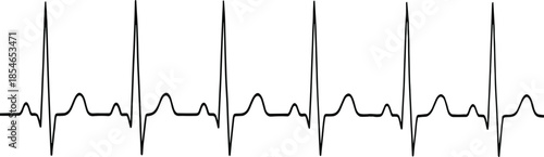 Electrocardiogram silhouettes, heartbeat waveforms, medical rhythm illustration, cardiology design, health monitoring concept, hospital equipment vector, diagnostic chart art