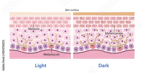 The mechanism of skin pigmentation vector illustration on white background. Comparison of light and dark skin tones are produced by melanocytes in the epidermal layer. Skin care and anatomy concept.