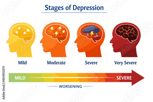 Stages of depression: visual representation from mild to very severe