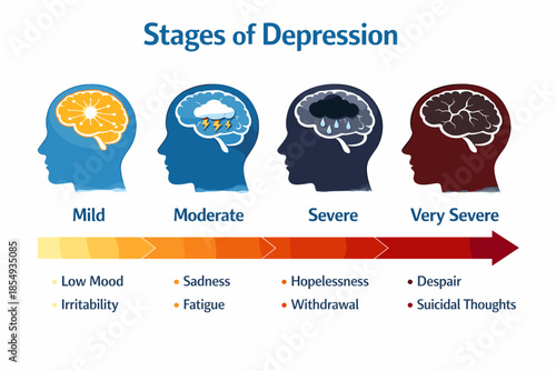 Stages of depression: visual representation from mild to very severe