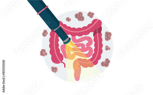 Colonoscopy procedure for healthy gut and bowel examination