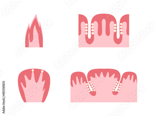 舌の乳頭のイラスト