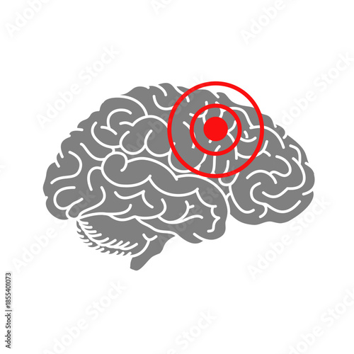 Illustration of pain in the human brain. Suitable for medical vector elements, headaches, bleeding locations, strokes, brain cancer or other medical symbols