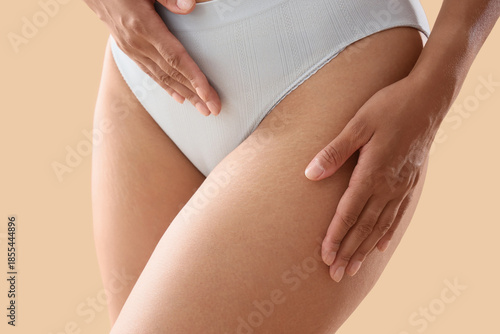 Wallpaper Mural Young woman in underwear with stretch marks on beige background, closeup Torontodigital.ca