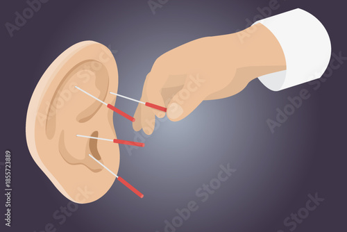 Ear acupuncture. Human ear is studded with acupuncture needles. Chinese needle alternative medicine. Flat isometric vector illustration.