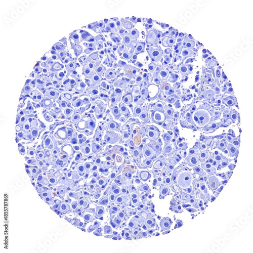 Microscopic view of human liver cells stained blue and pink on a black background tissue